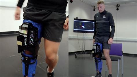 The Body & The Bionic: Navigating Physical Recovery